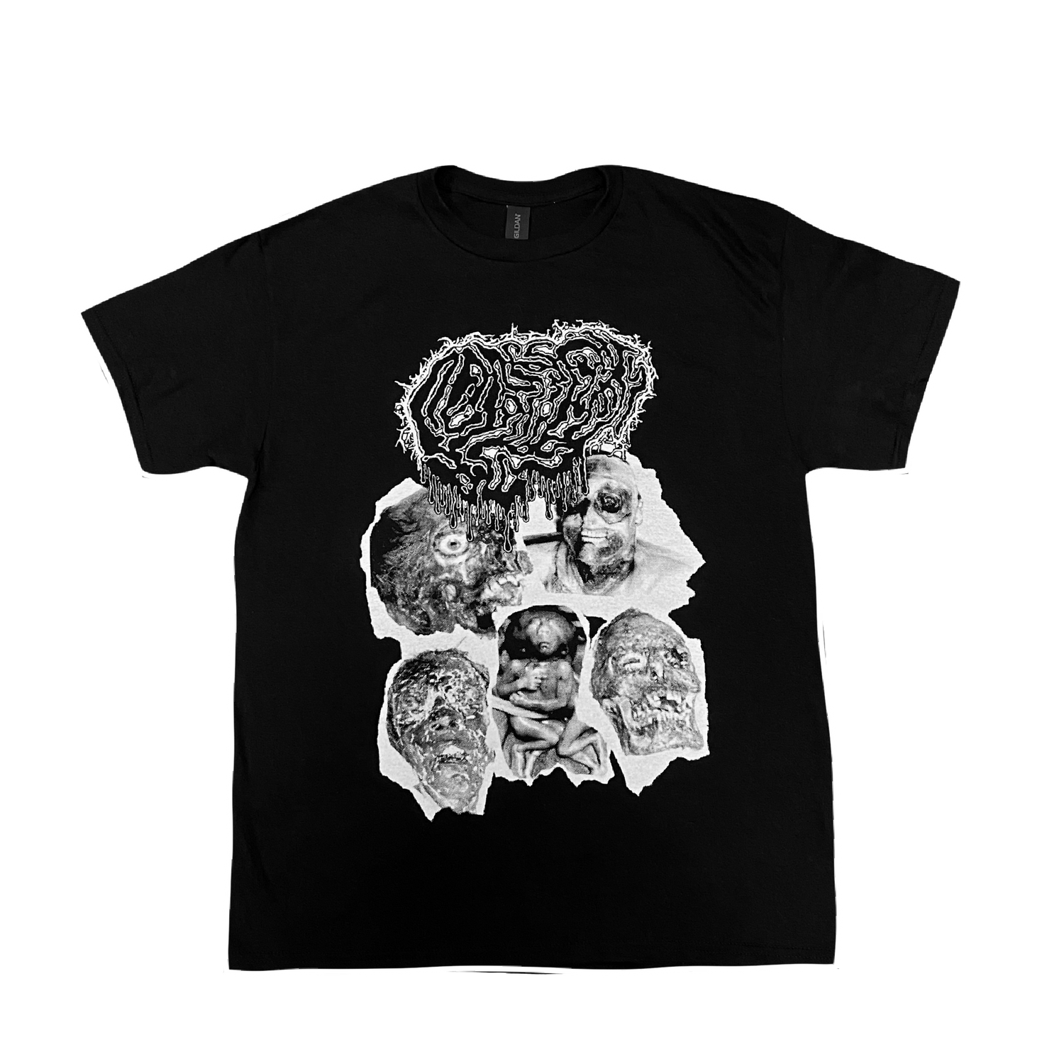 FETAL DEFORMITY TEE