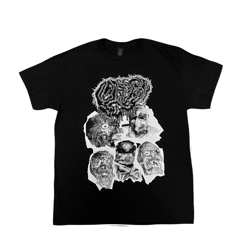 FETAL DEFORMITY TEE